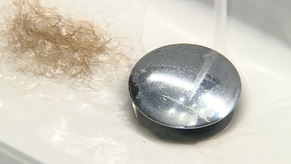 Pelos en el lavabo