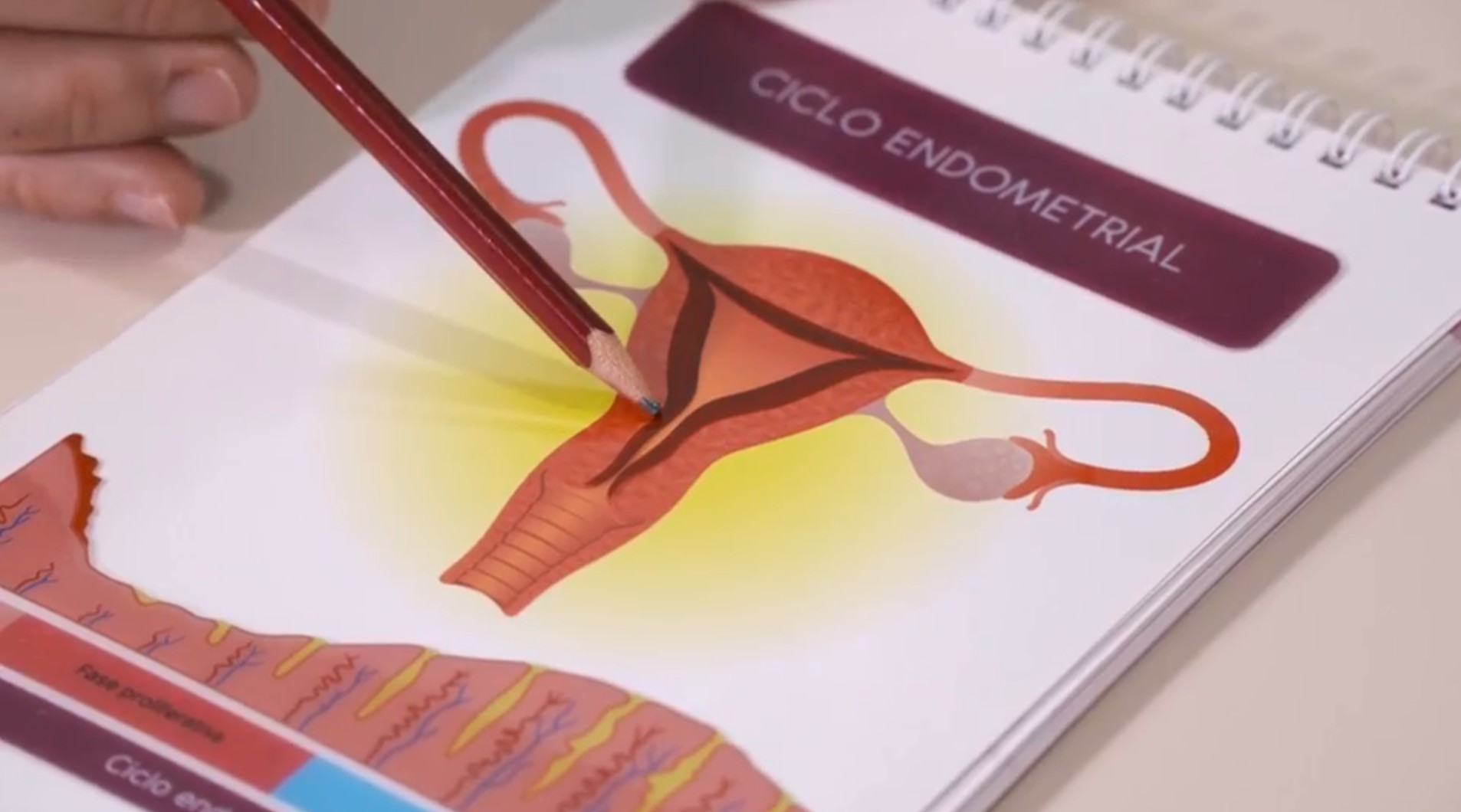 Endometriosis 