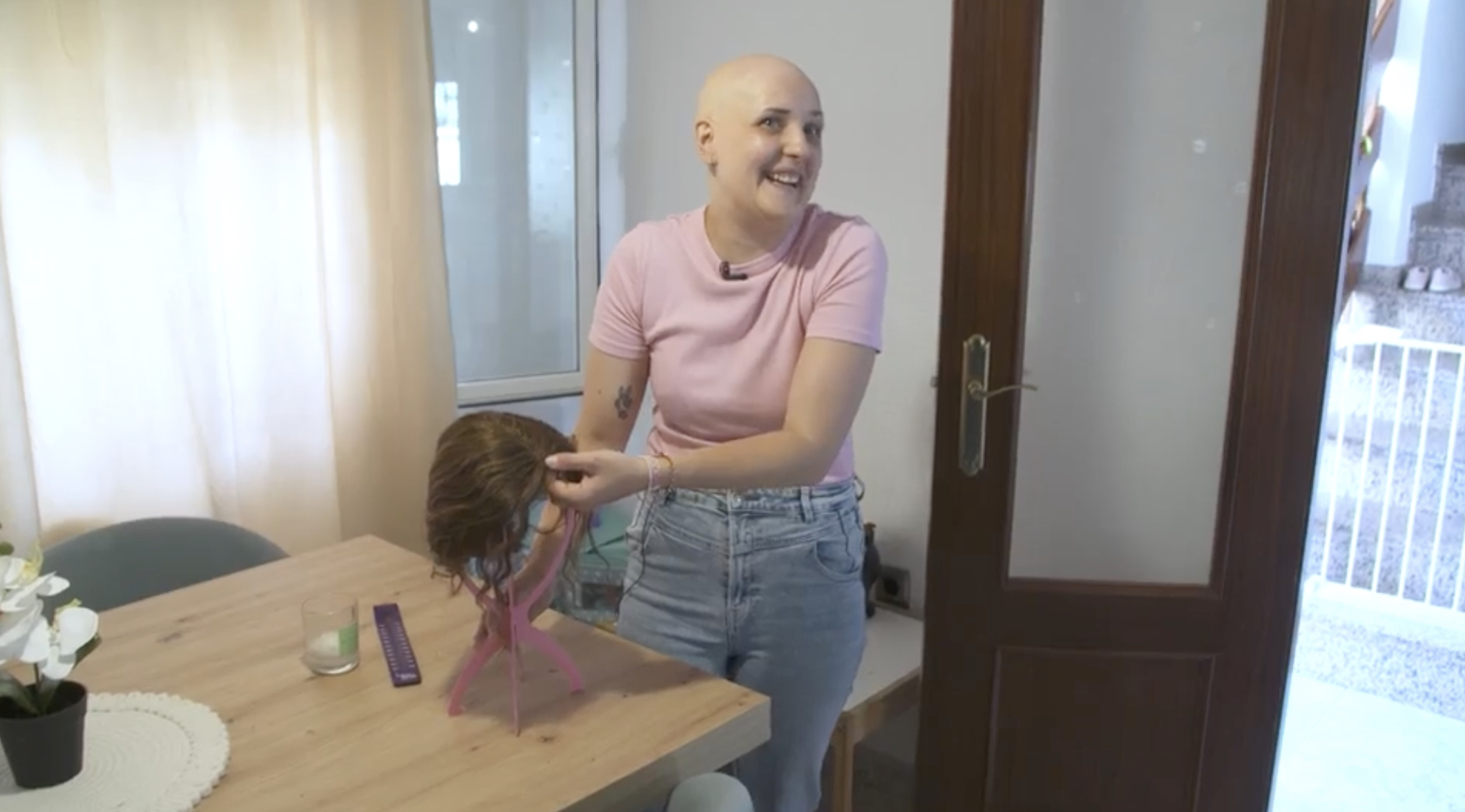 Alopecia femenina