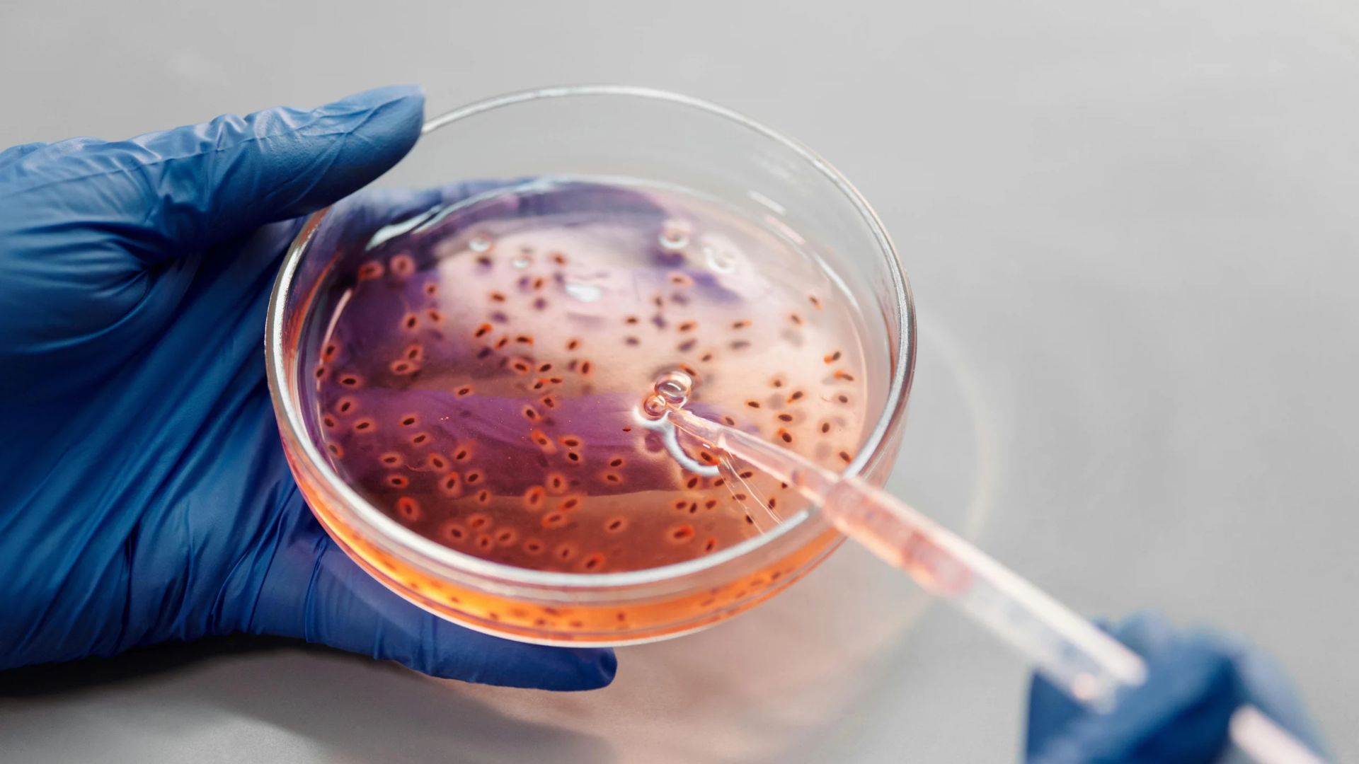 Análisis de bacterias en una imagen de archivo