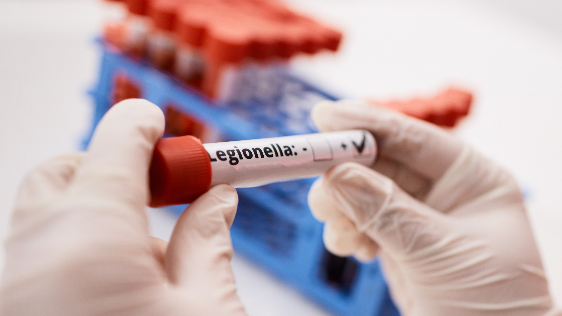 Un análisis de laboratorio para detectar la presencia de Legionella, la bacteria causante de la legionelosis,