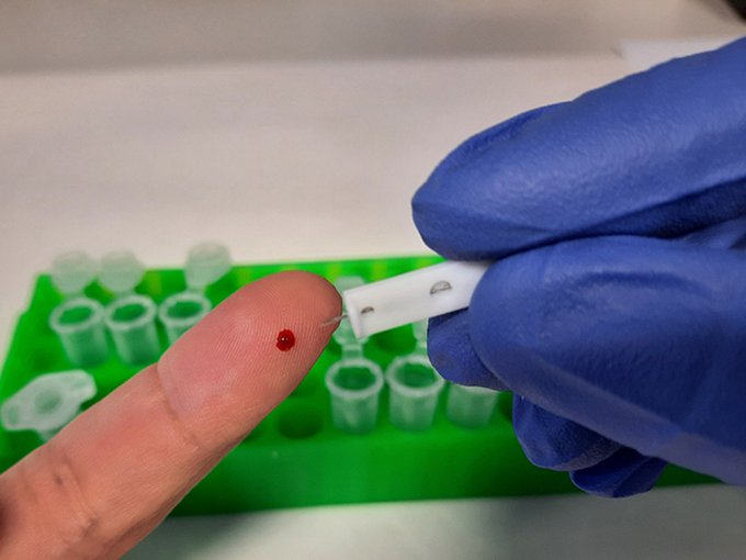 Nuevo test COVID-19 del CSIC