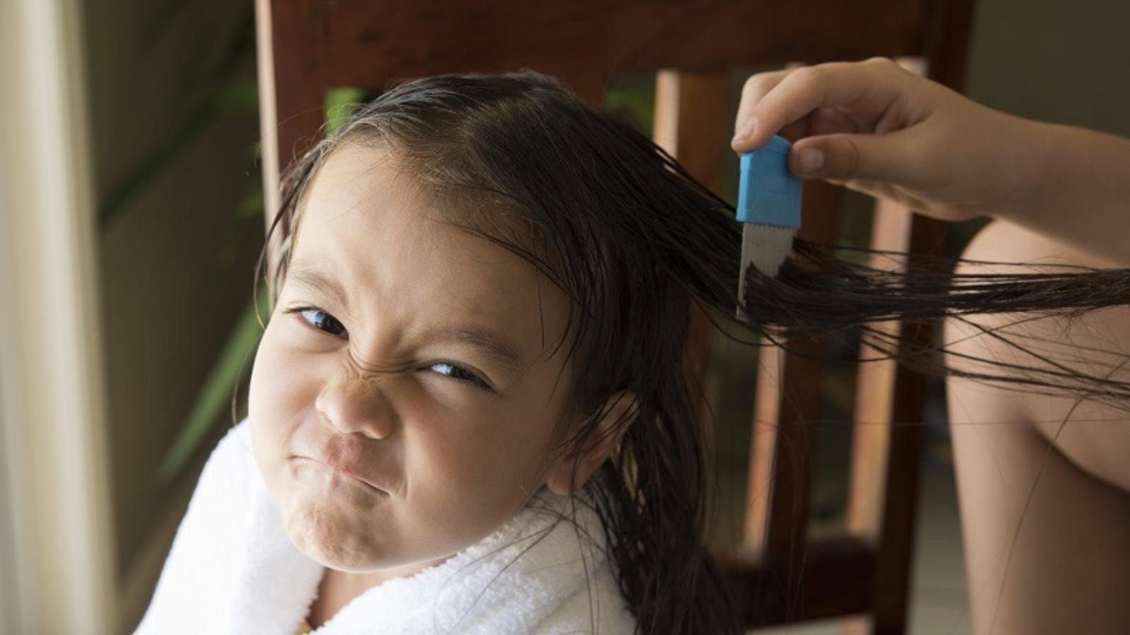 Limpian la cabeza de una niña que tiene piojos. Imagen de Archivo. 